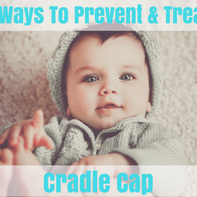How to Prevent Cradle Cap In Babies