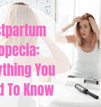 Postpartum alopecia