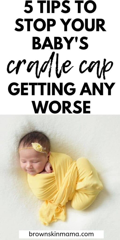 Learn about the causes of cradle cap and how to get rid of it using some great remedies that you can try on your baby.
